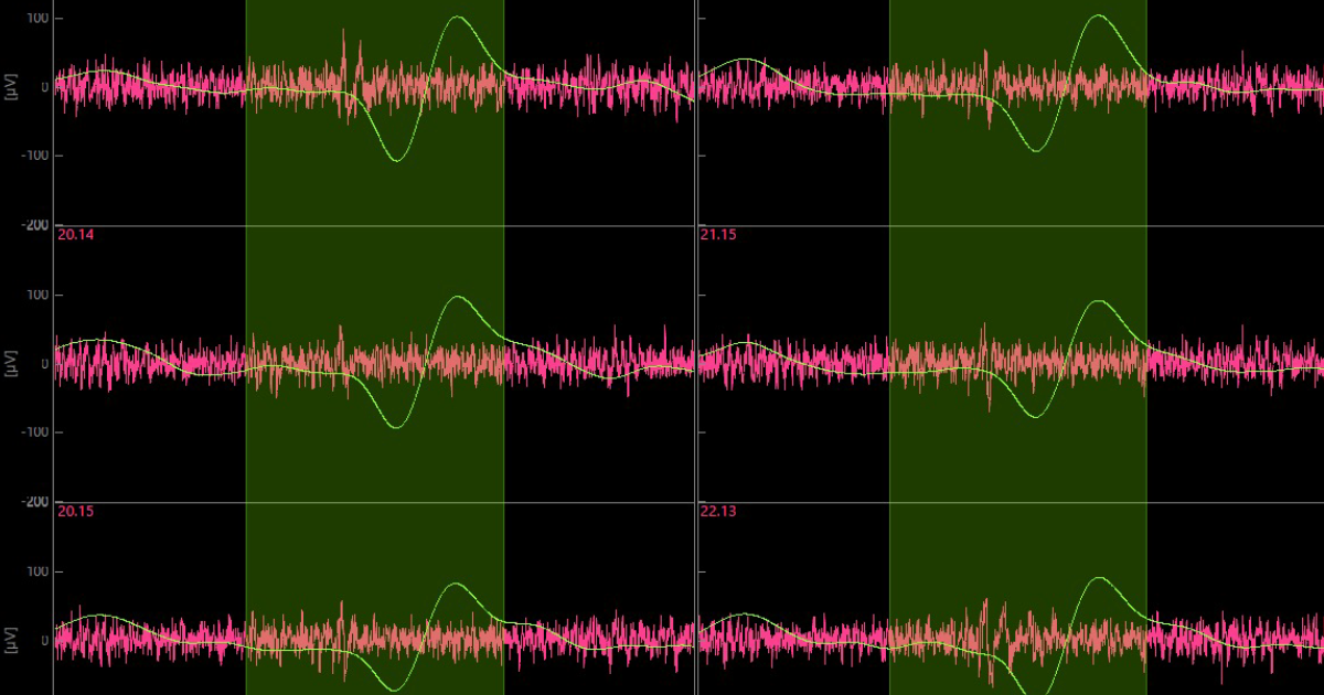 ED Waveform recorded with HD MEA